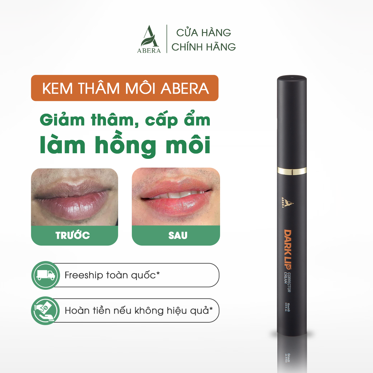 Kem Thâm Môi Abera - Hỗ trợ khắc phục thâm môi, bong tróc môi, dưỡng ẩm môi, giúp môi mềm mịn đỏ hồng tự nhiên, hỗ trợ môi đẹp tự nhiên (15ml)
