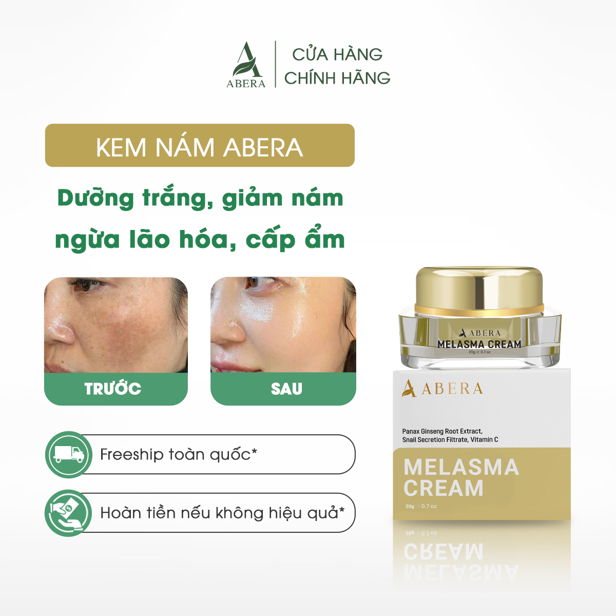 Kem Nám Abera - Hỗ Trợ Xử Lý Nám, Đồi Mồi, Tàn Nhang - 20g