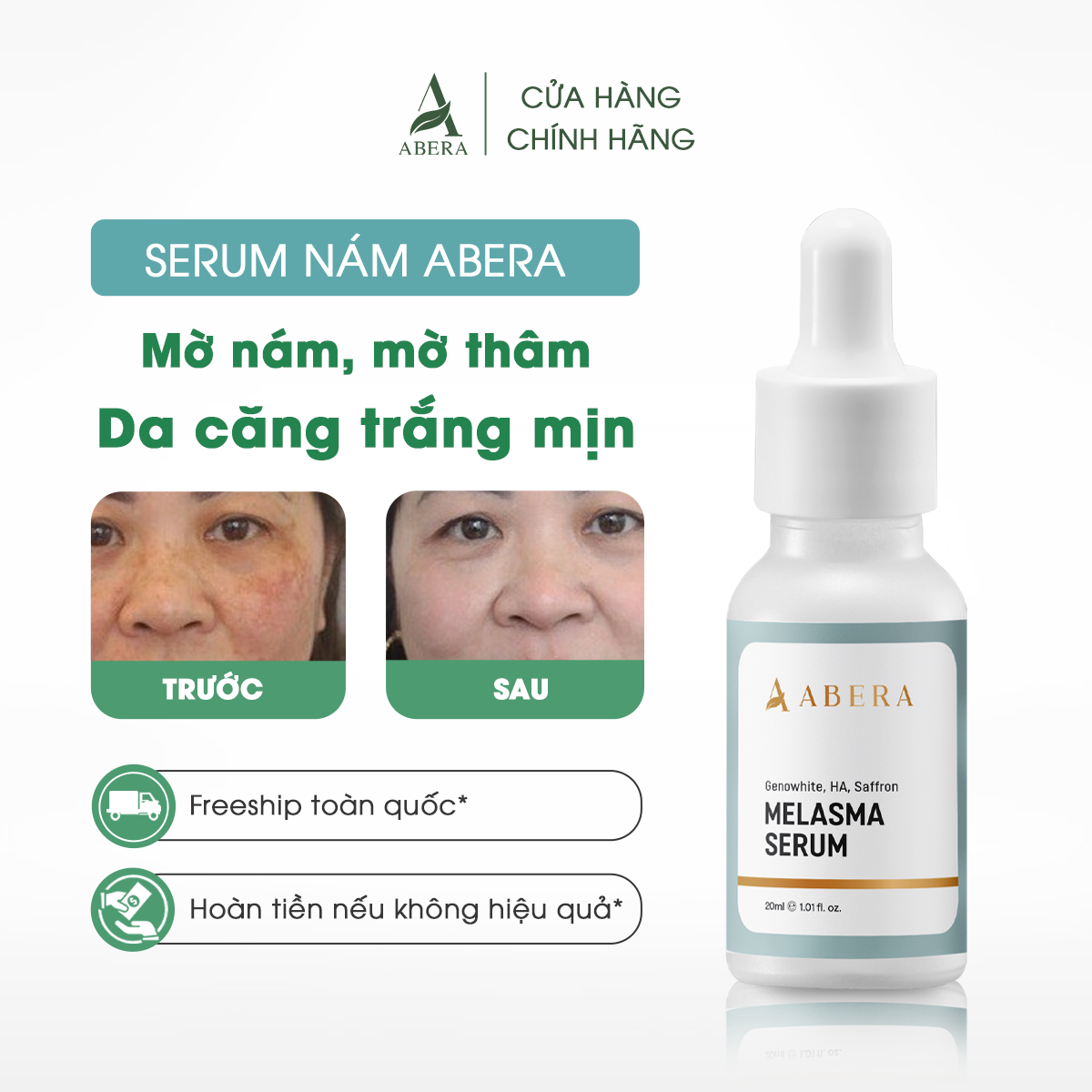 Serum Nám Da Abera - Hỗ Trợ Xử Lý Nám, Đồi Mồi, Tàn Nhang - 20ml