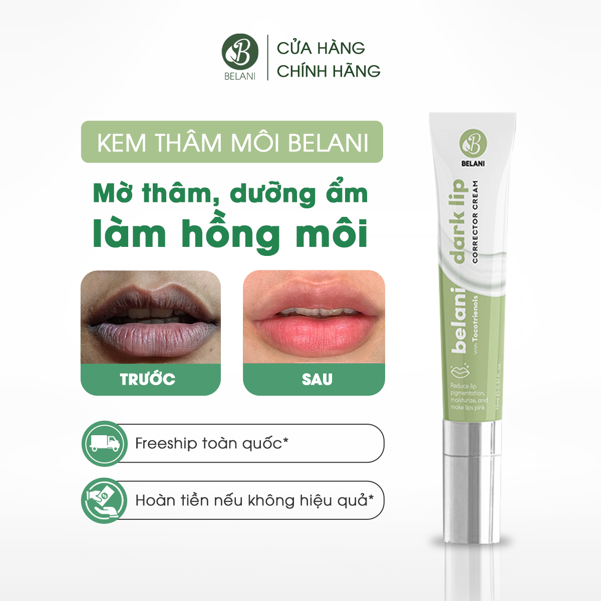 Kem Xoá Thâm Môi Belani, Dành Cho Nam & Nữ – Giúp Làm Mờ Thâm Môi, Dưỡng Ẩm Sâu Cho Môi Khô Nứt Nẻ