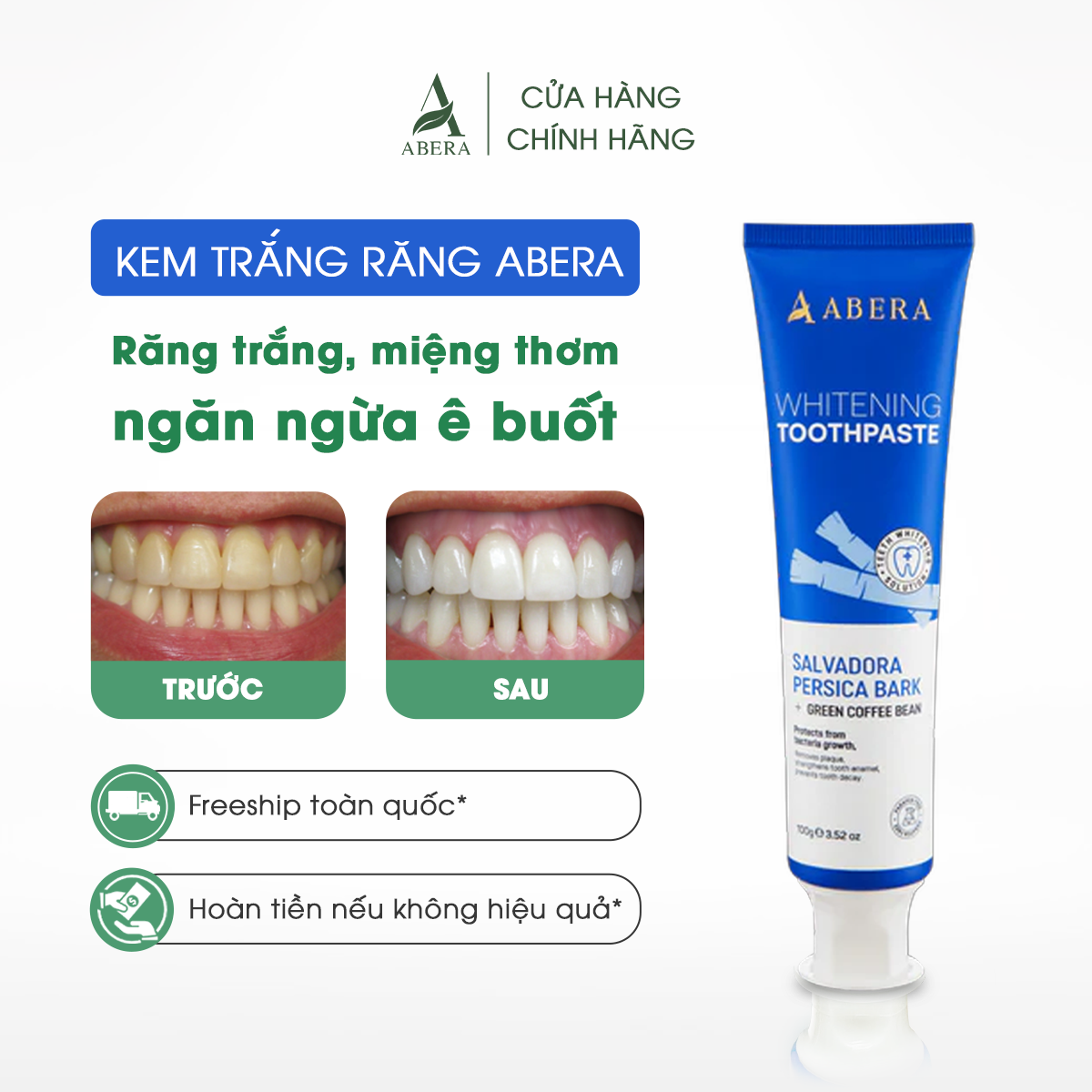 Kem Trắng Răng Abera - Hỗ trợ Loại Bỏ Cao Răng Mảng Bám, Làm Trắng Răng 2 Chiều, Cải Thiện Vết Ố Vàng, Làm Thơm Miệng